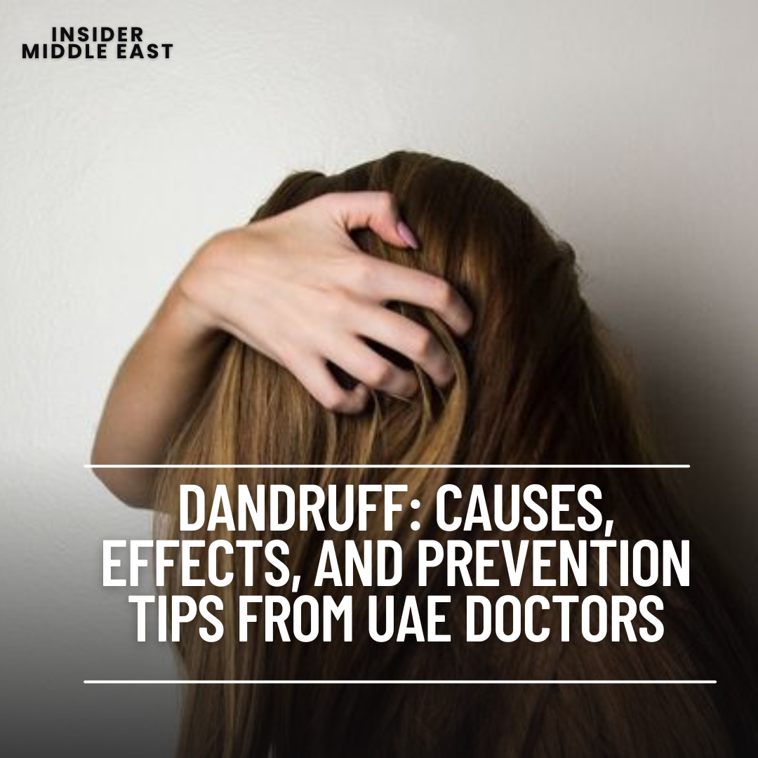 UAE Doctors emphasise that scratching the scalp due to dandruff-induced itching can result in temporary hair loss.